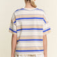 Stripe Oversized Short Sleeve Top