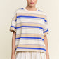 Stripe Oversized Short Sleeve Top